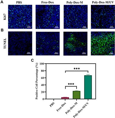 Light-Responsive Micelles Loaded With Doxorubicin for Osteosarcoma Suppression